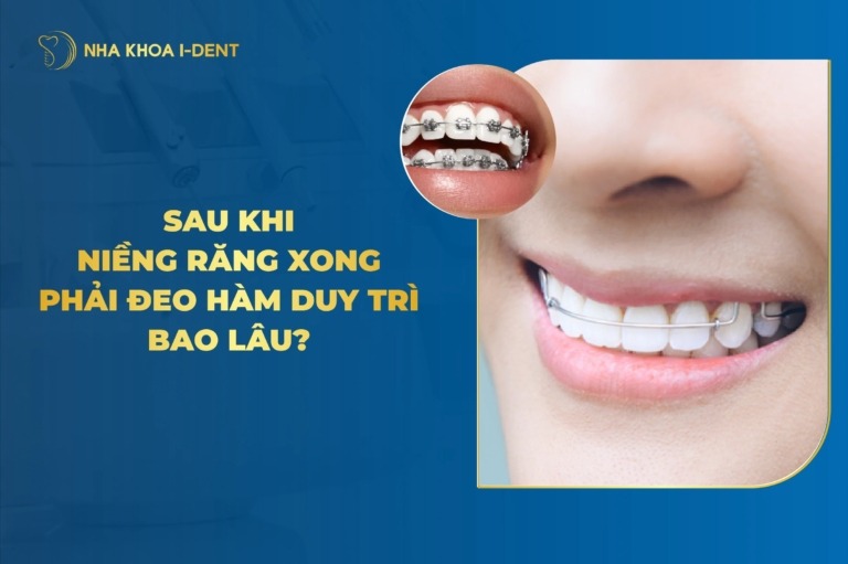 Niềng Răng Xong Phải Đeo Hàm Duy Trì Bao Lâu?