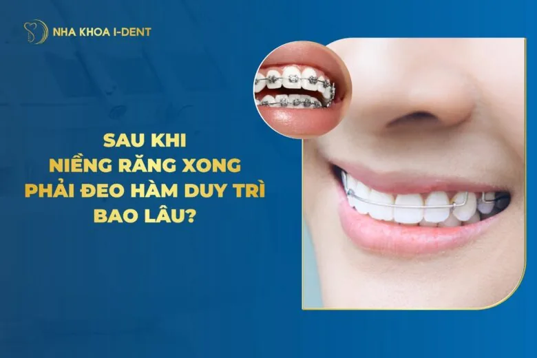 Niềng Răng Xong Phải Đeo Hàm Duy Trì Bao Lâu?