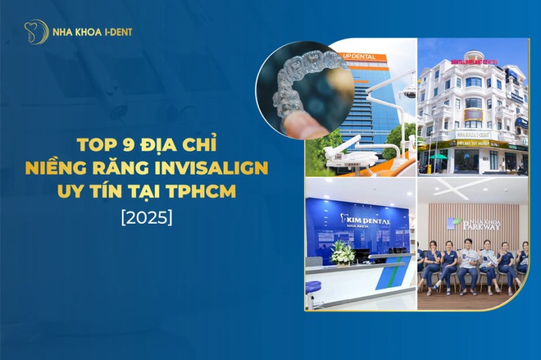 Top 9 Địa Chỉ Niềng Răng Invisalign Uy Tín Tại TPHCM [2025]
