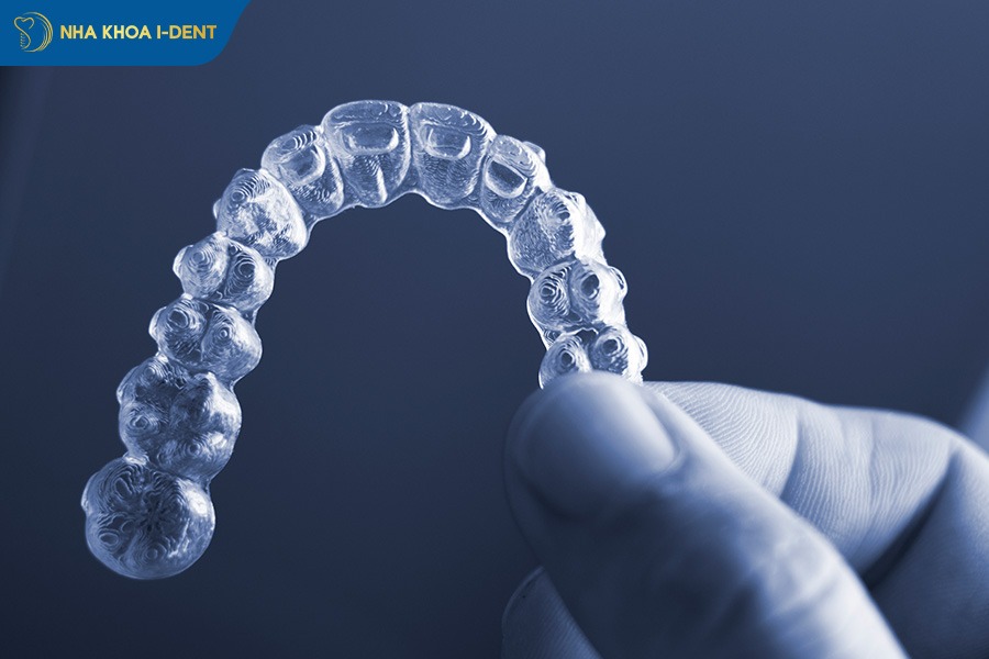 niềng răng loại nào tốt