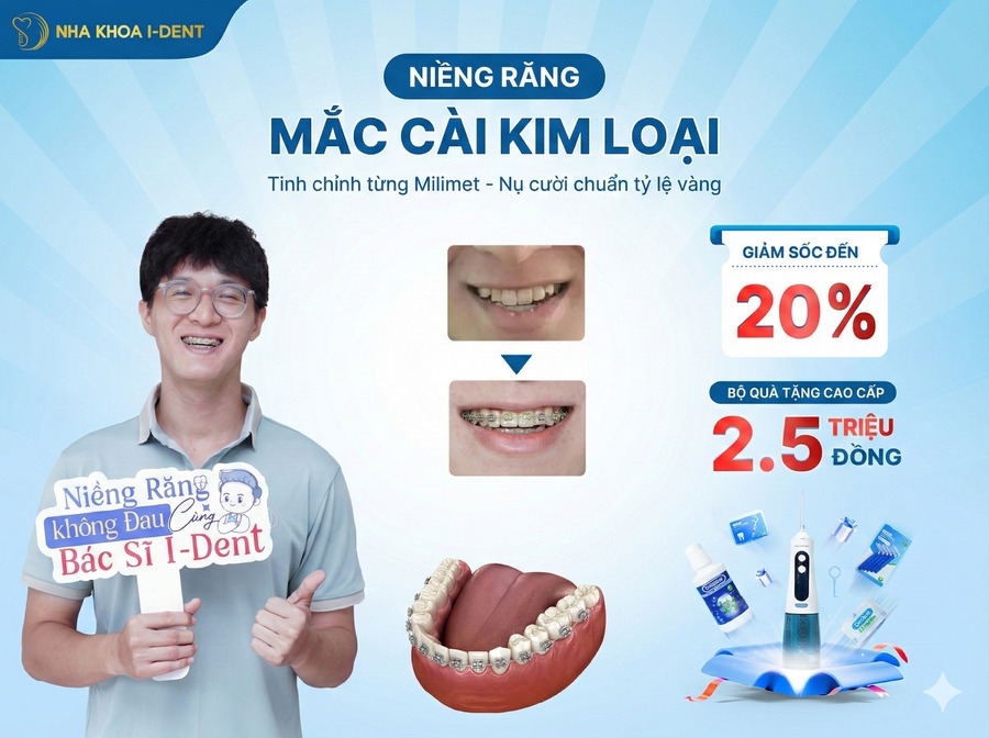 niềng răng là gì