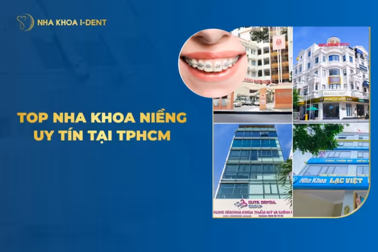 niềng răng uy tín