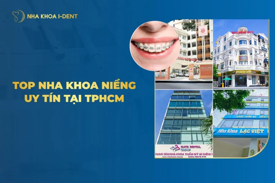 niềng răng uy tín
