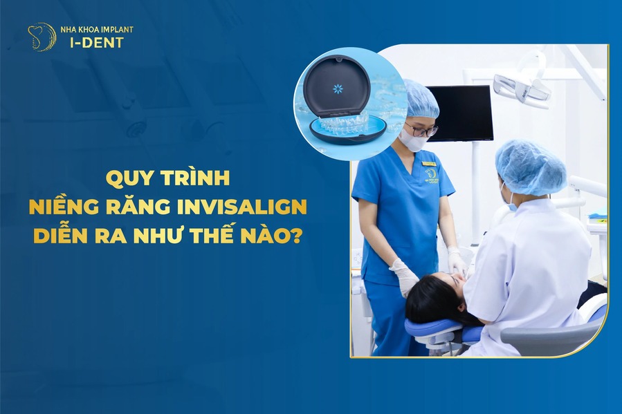 Quy Trình Niềng Răng Invisalign Diễn Ra Như Thế Nào?