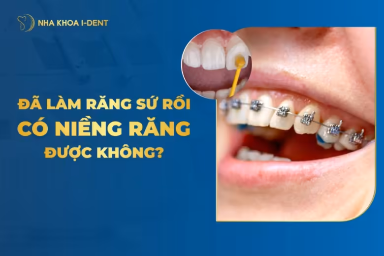 răng sứ có niềng được không