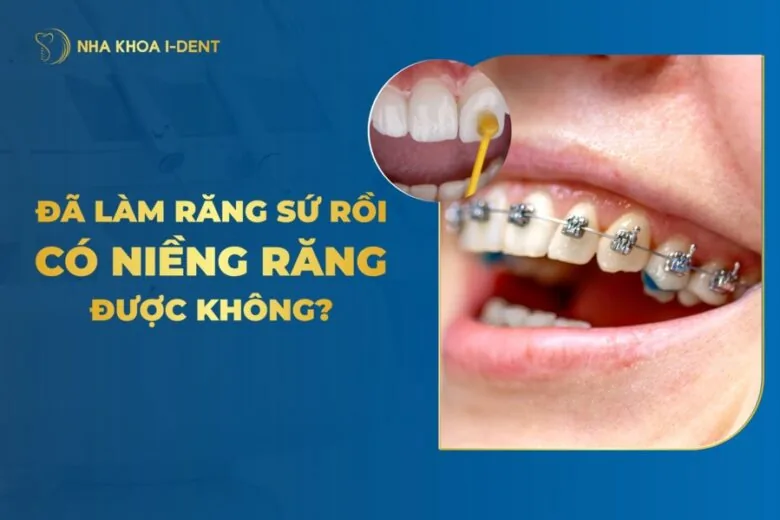 răng sứ có niềng được không