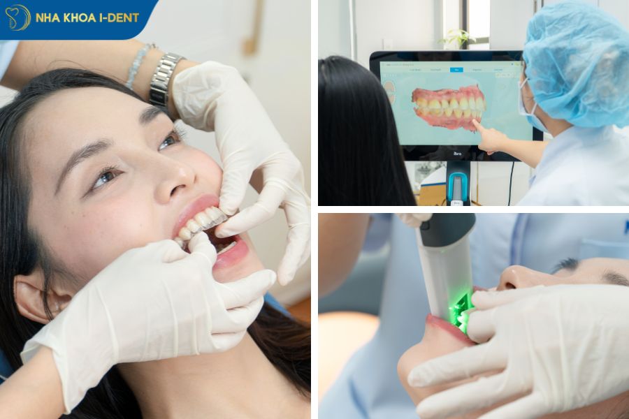 rút ngắn thời gian niềng răng invisalign