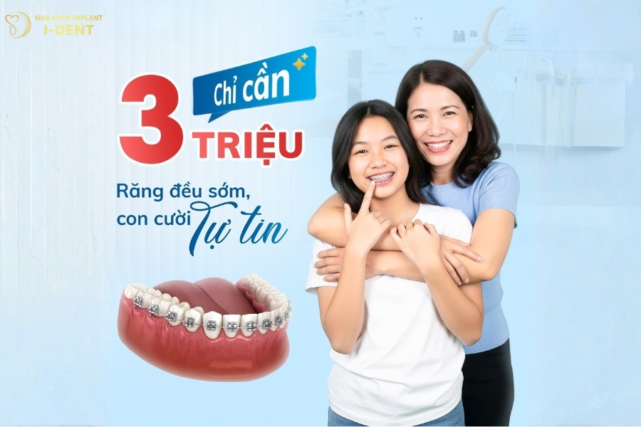 trả góp niềng răng