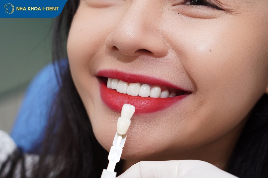 trong-rang-khenh-gia-bao-nhieu