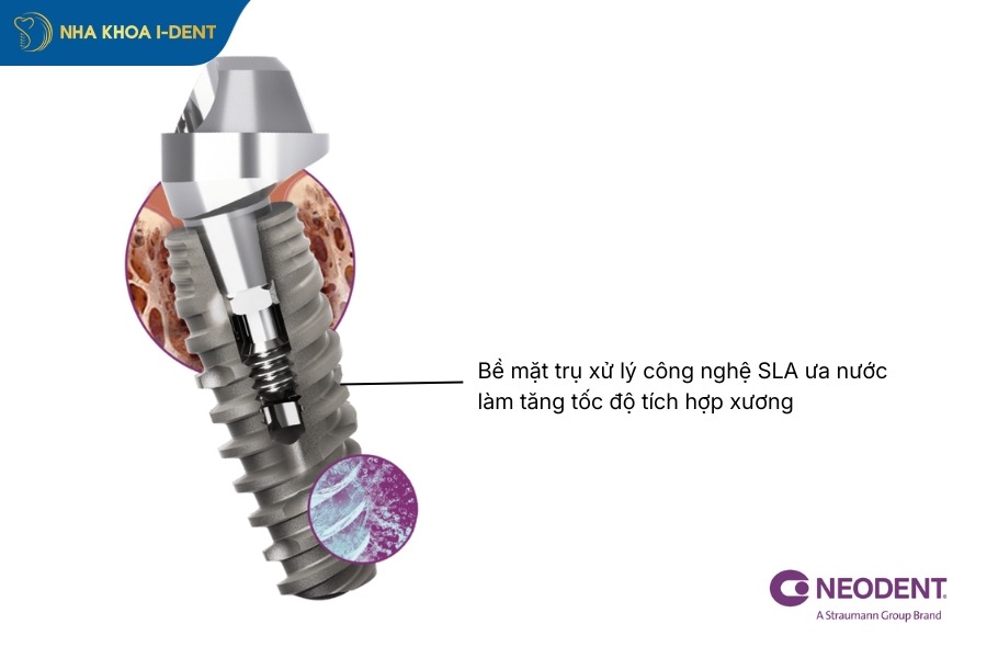 be-mat-tru-implant-neodent