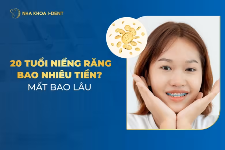 20 tuổi niềng răng bao nhiêu tiền