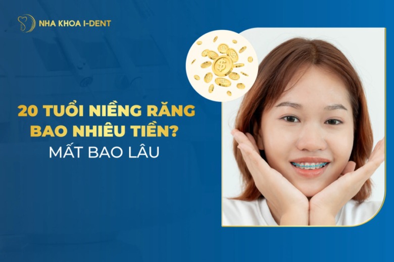 20 tuổi niềng răng bao lâu? Giá bao nhiêu tiền?