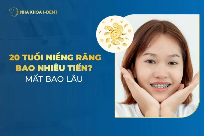 20 tuổi niềng răng bao nhiêu tiền