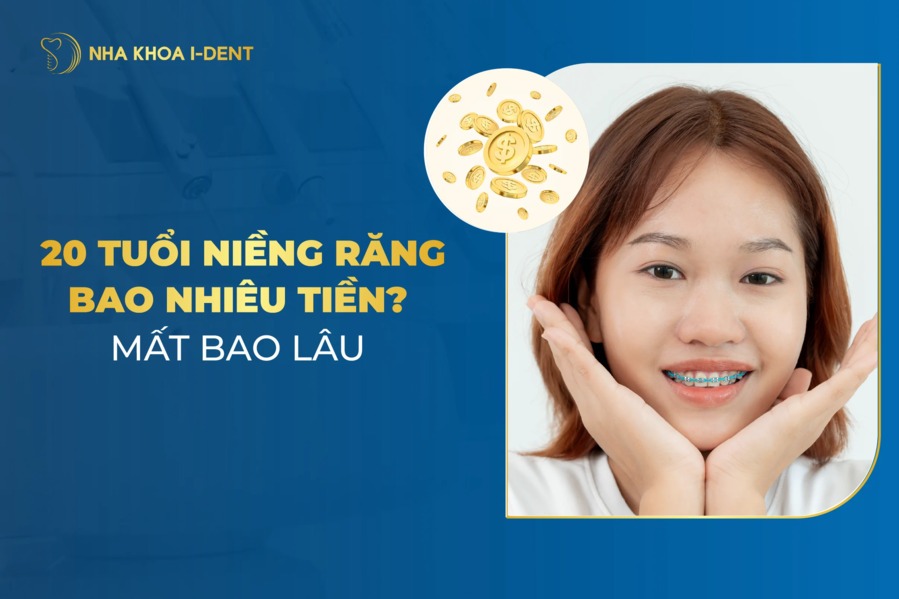 20 tuổi niềng răng bao lâu? Giá bao nhiêu tiền?