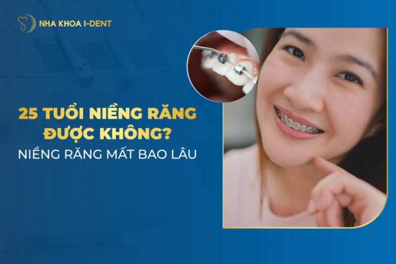 25 tuổi niềng răng được không? Hiệu quả tốt không? Mất bao lâu?