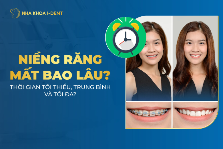 Niềng răng mất bao lâu? Thời gian hoàn thành mọi trường hợp?