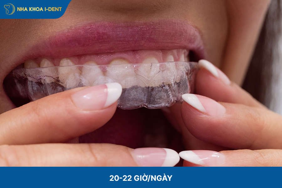 Hiệu quả phụ thuộc vào thời gian đeo khay