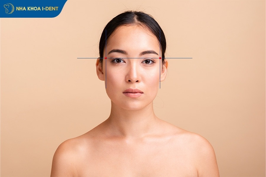 hóp thái dương khi niềng răng