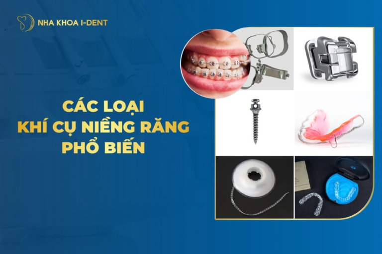 khí cụ niềng răng