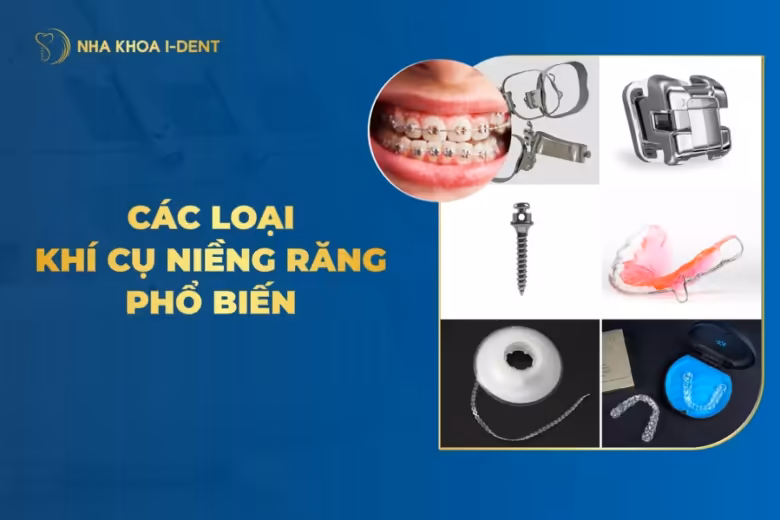 khí cụ niềng răng
