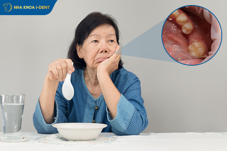 mất 1 răng hàm có sao không