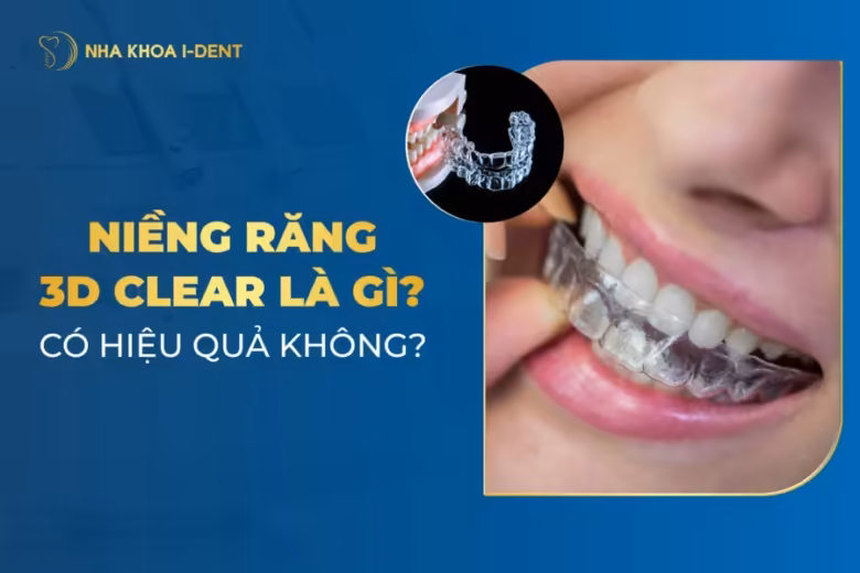 niềng răng 3d clear