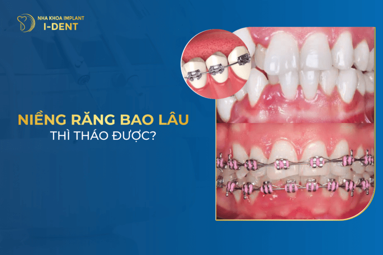 nieng-rang-bao-lau-thi-thao-duoc-co-nen-thao-nieng-som