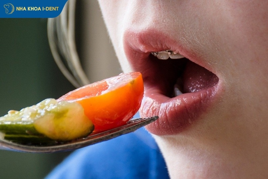 niềng răng bao lâu thì tháo được