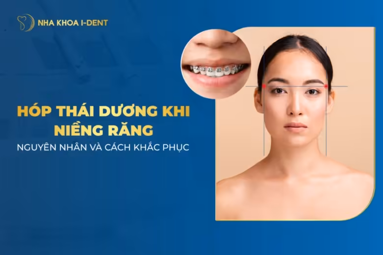 niềng răng bị hóp thái dương