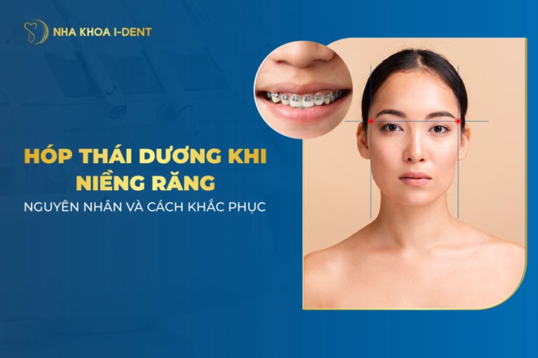 Hóp thái dương khi niềng răng: Nguyên nhân và cách khắc phục