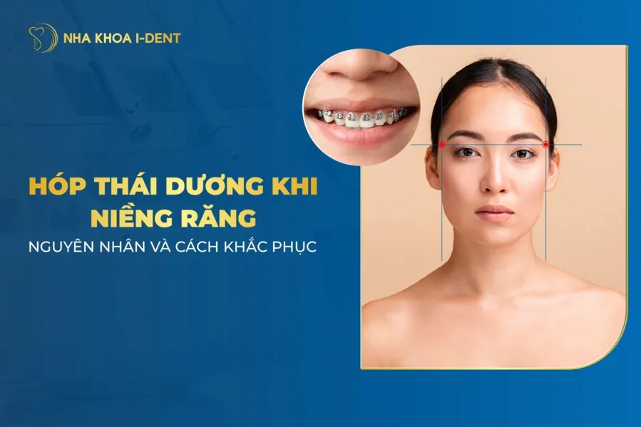 niềng răng bị hóp thái dương