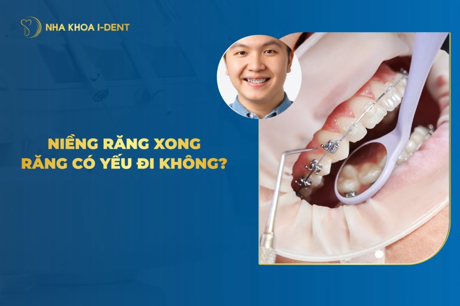 Niềng răng xong răng có yếu đi không?