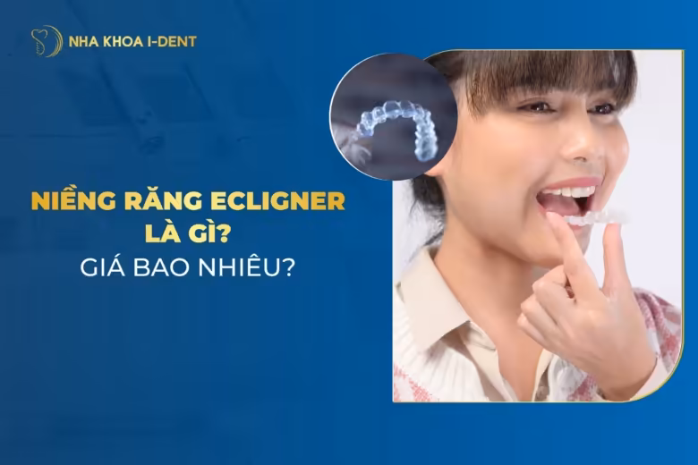 niềng răng ecligner