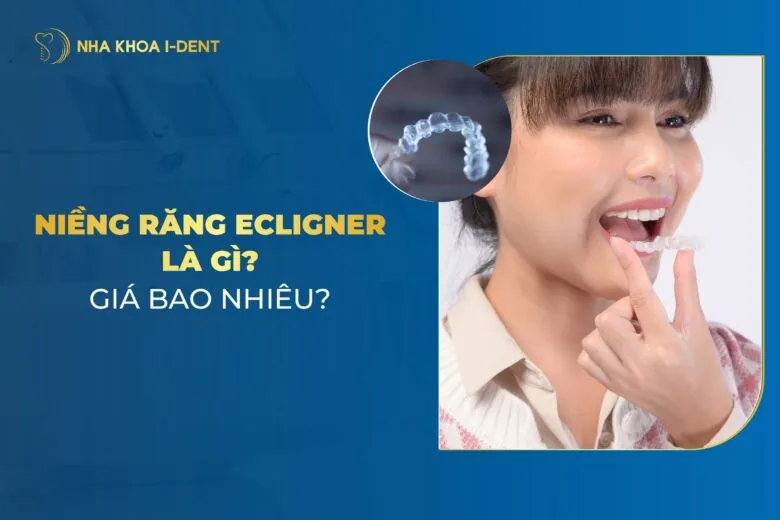 niềng răng ecligner