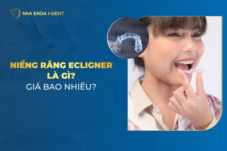 Niềng răng eCligner là gì? Giá tiền và ưu, nhược điểm