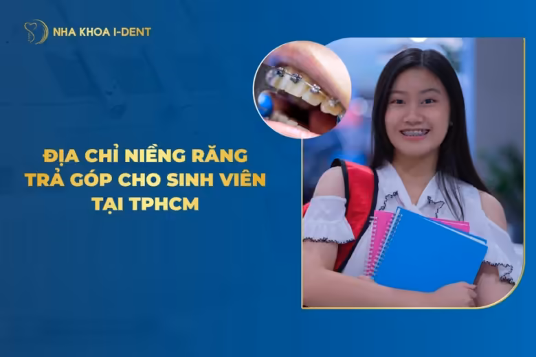 niềng răng giá sinh viên