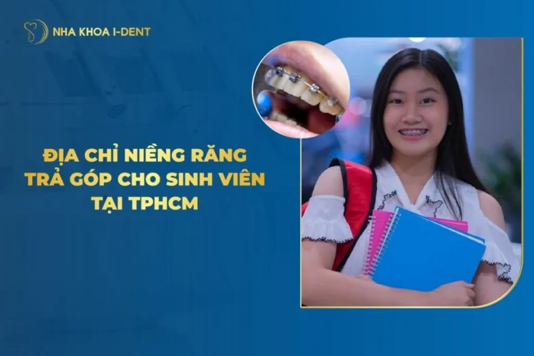 niềng răng giá sinh viên