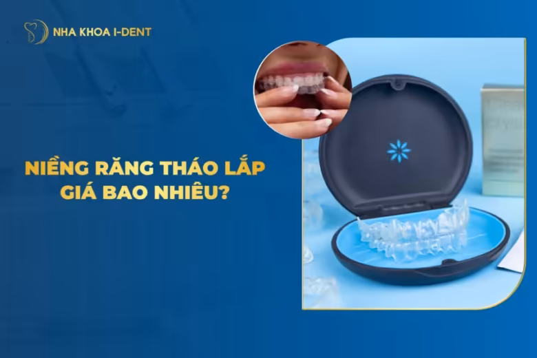niềng răng tháo lắp giá bao nhiêu