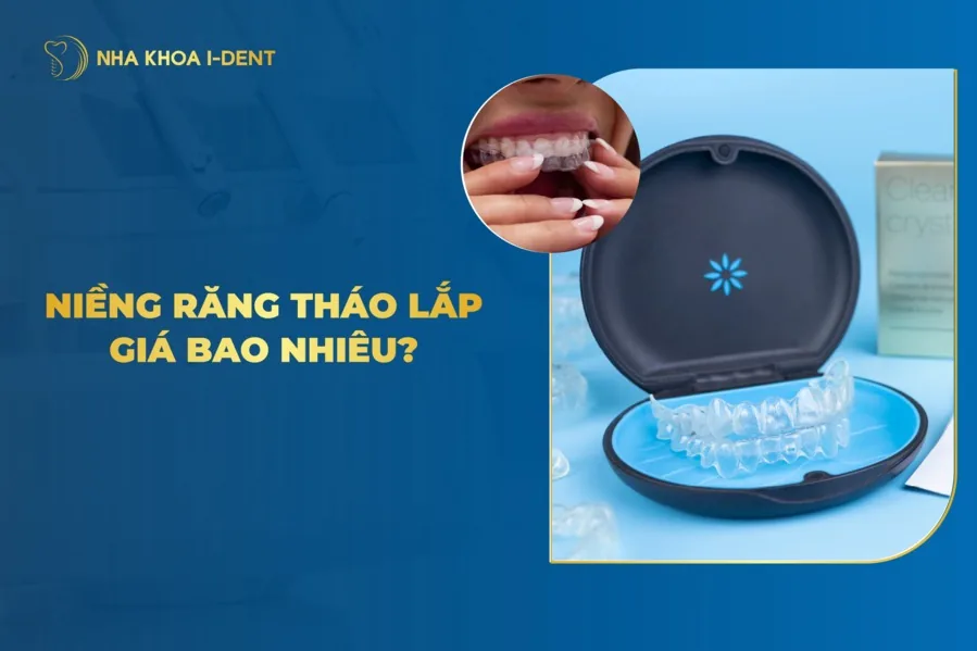 niềng răng tháo lắp giá bao nhiêu