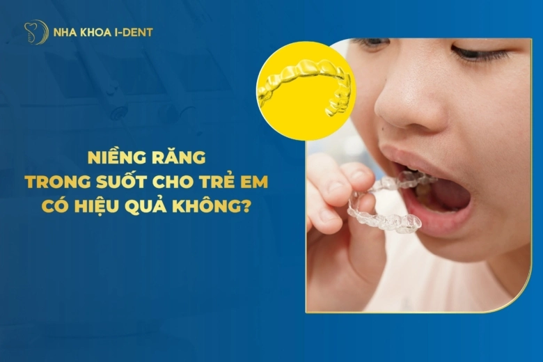 Niềng Răng Trong Suốt Cho Trẻ Hiệu Quả Không? Chi Phí?