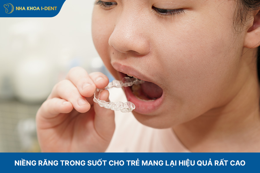 Niềng răng trong suốt cho trẻ em mang lại hiệu quả cao