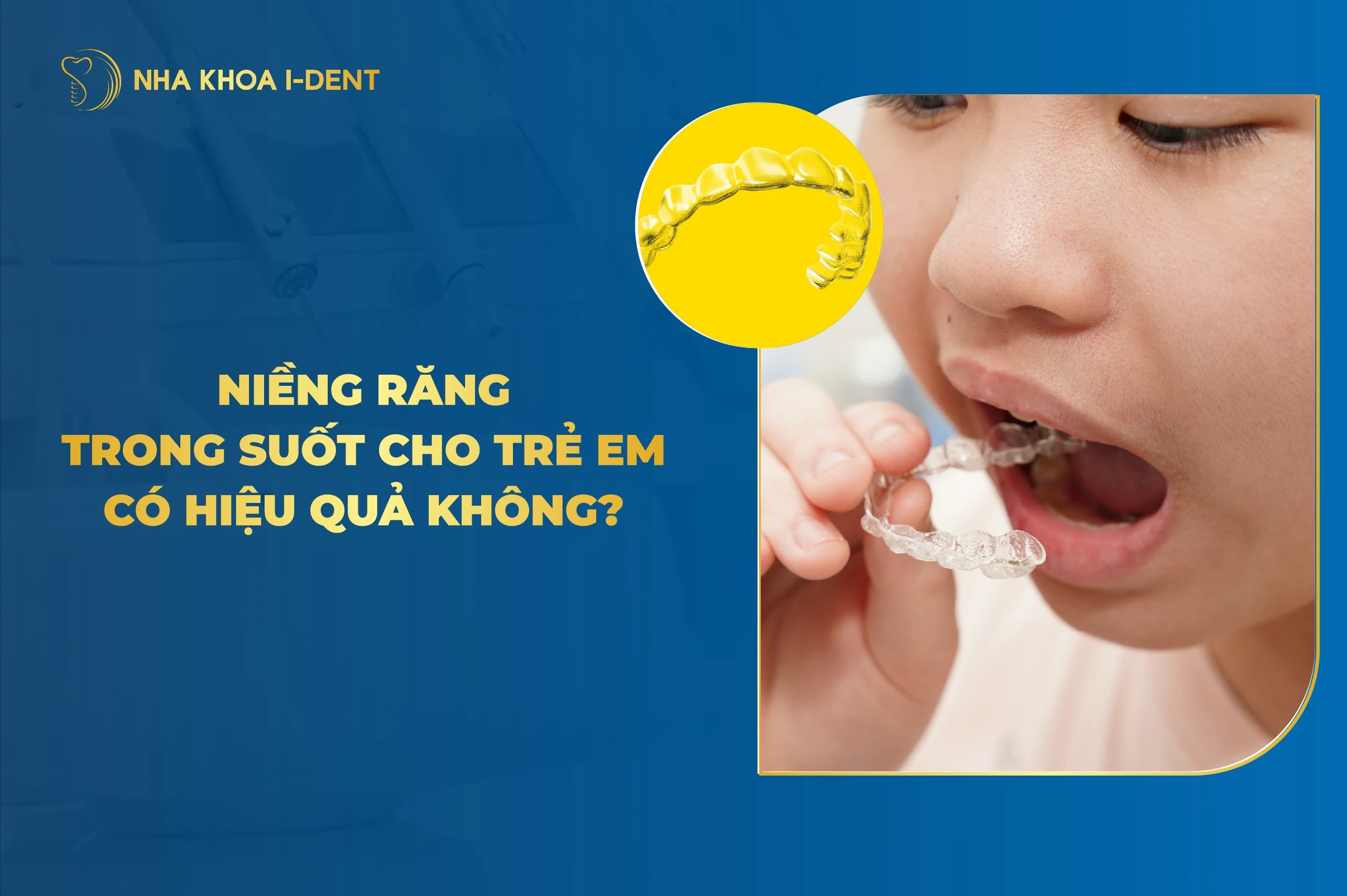 Niềng Răng Trong Suốt Cho Trẻ Em Có Hiệu Quả Không?