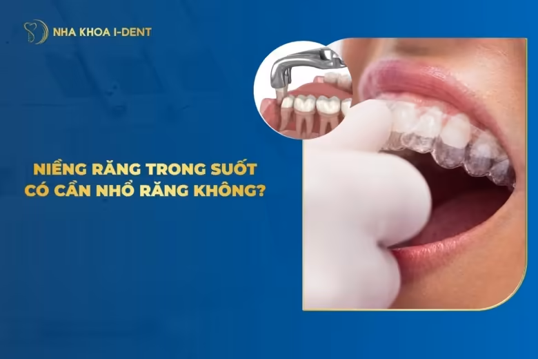 Niềng Răng Trong Suốt Có Cần Phải Nhổ Răng Không?