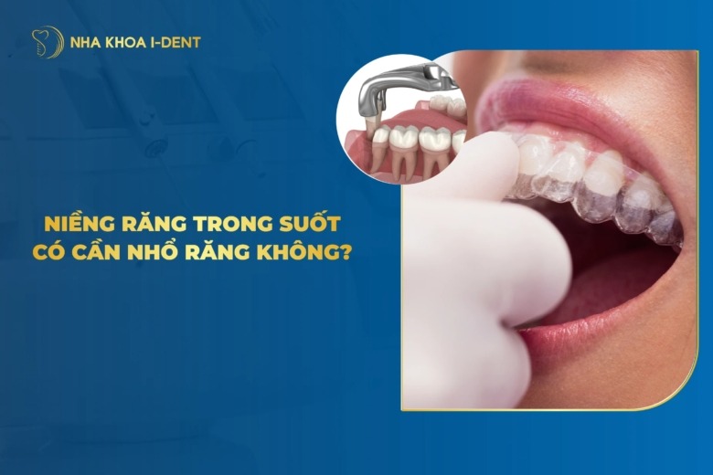 Niềng Răng Trong Suốt Có Cần Nhổ Răng Không?