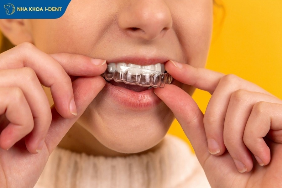 niềng răng trong suốt invisalign