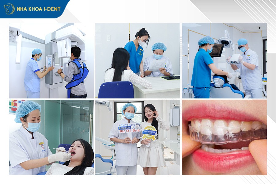 Quy trình niềng răng mọc lệch