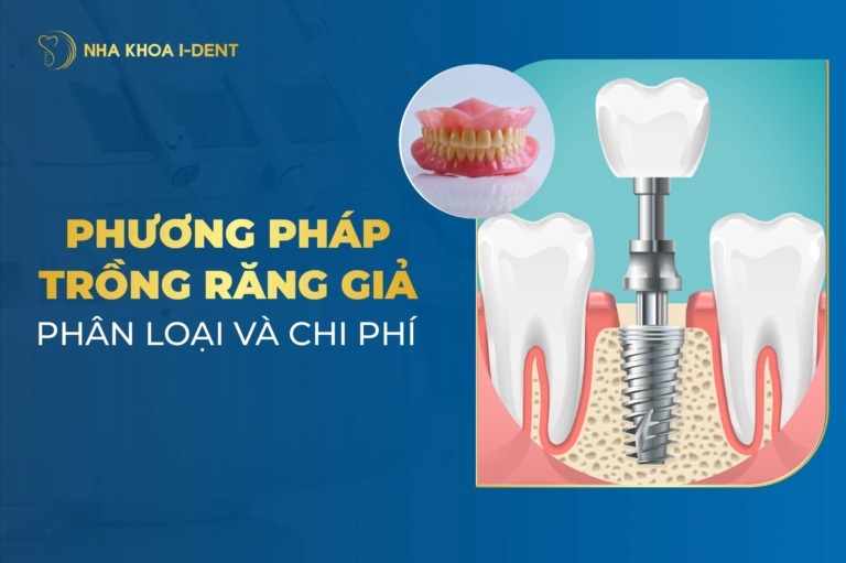 Phương Pháp Trồng Răng Giả: Phân Loại Và Chi Phí