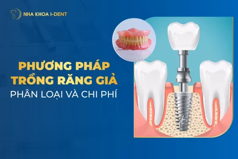 Phương Pháp Trồng Răng Giả: Phân Loại Và Chi Phí