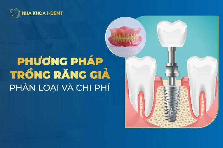 Phương Pháp Trồng Răng Giả: Phân Loại Và Chi Phí