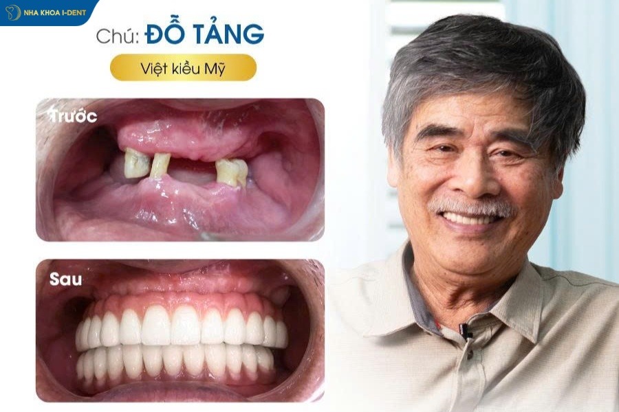 cấy ghép implant cho người già